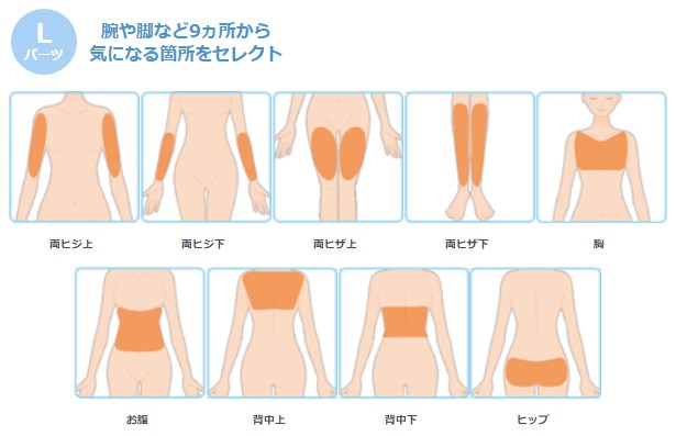 ミュゼのフリーセレクト美容脱毛コースのLパーツ