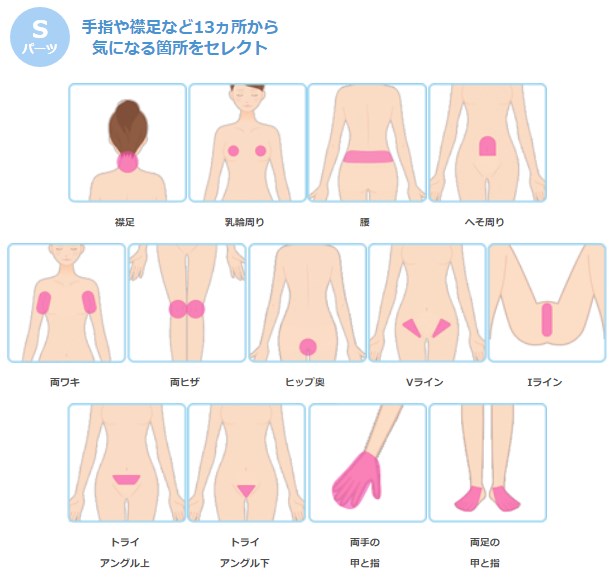 ミュゼのフリーセレクト美容脱毛コースのSパーツ
